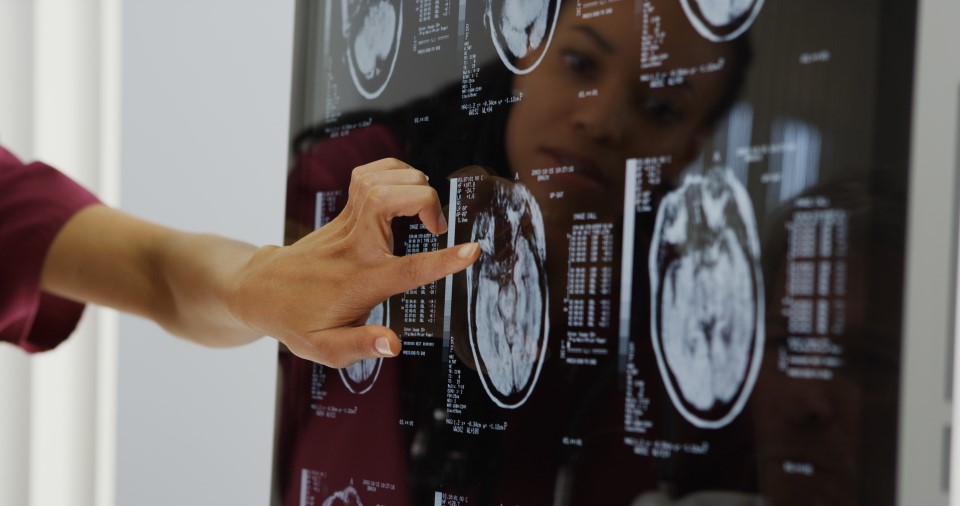 neuro-mri-image-scan_web